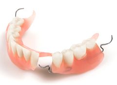 Prothese dentaire partielle
